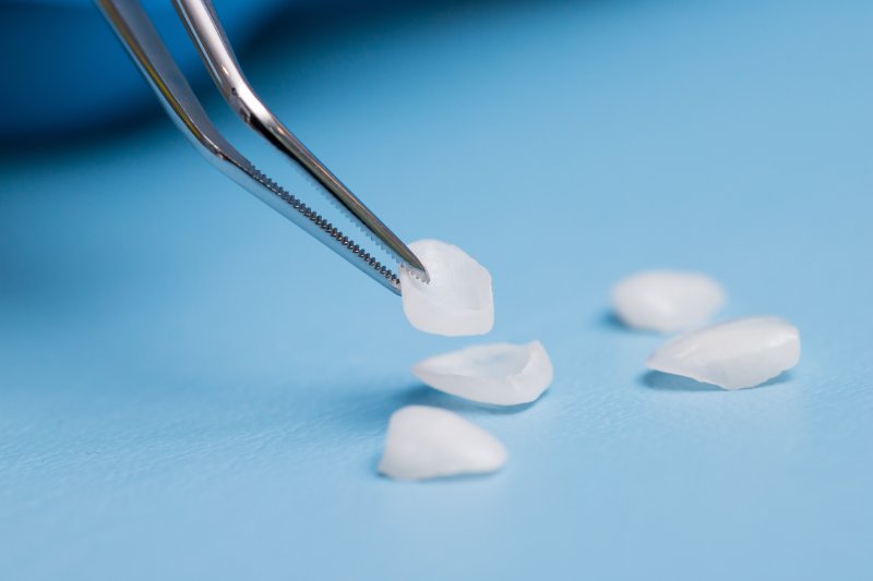 dentist picking up veneers with tweezers