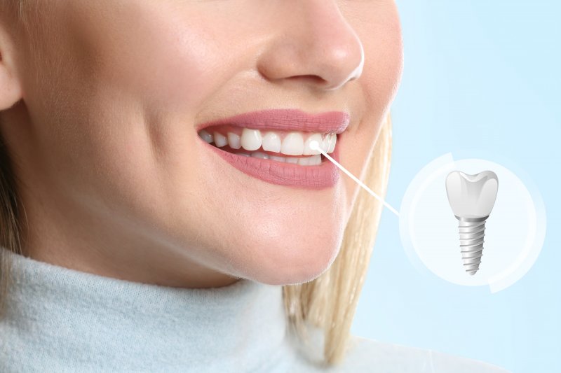 young woman with dental implant smiling